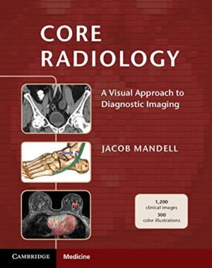 Core Radiology - A Visual Approach to Diagnostic Imaging Format: PDF eTextbooks ISBN-13: 978-1107679689 ISBN-10: 1107679680 Delivery: Instant Download Authors: Jacob Mandell Publisher: Cambridge University Press