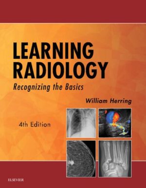 Learning Radiology - Recognizing the Basics (4th Edition) Format: PDF eTextbooks ISBN-13: 978-0323567299 ISBN-10: 0323567290 Delivery: Instant Download Authors: William Herring MD FACR Publisher: Elsevier